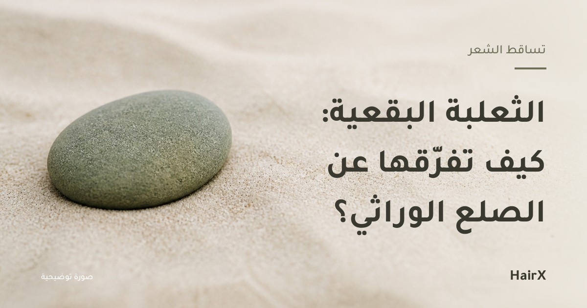 صورة توضيحية: حصاة نهرية ملساء على رمل فاتح — الثعلبة البقعية والفرق عن الصلع الوراثي