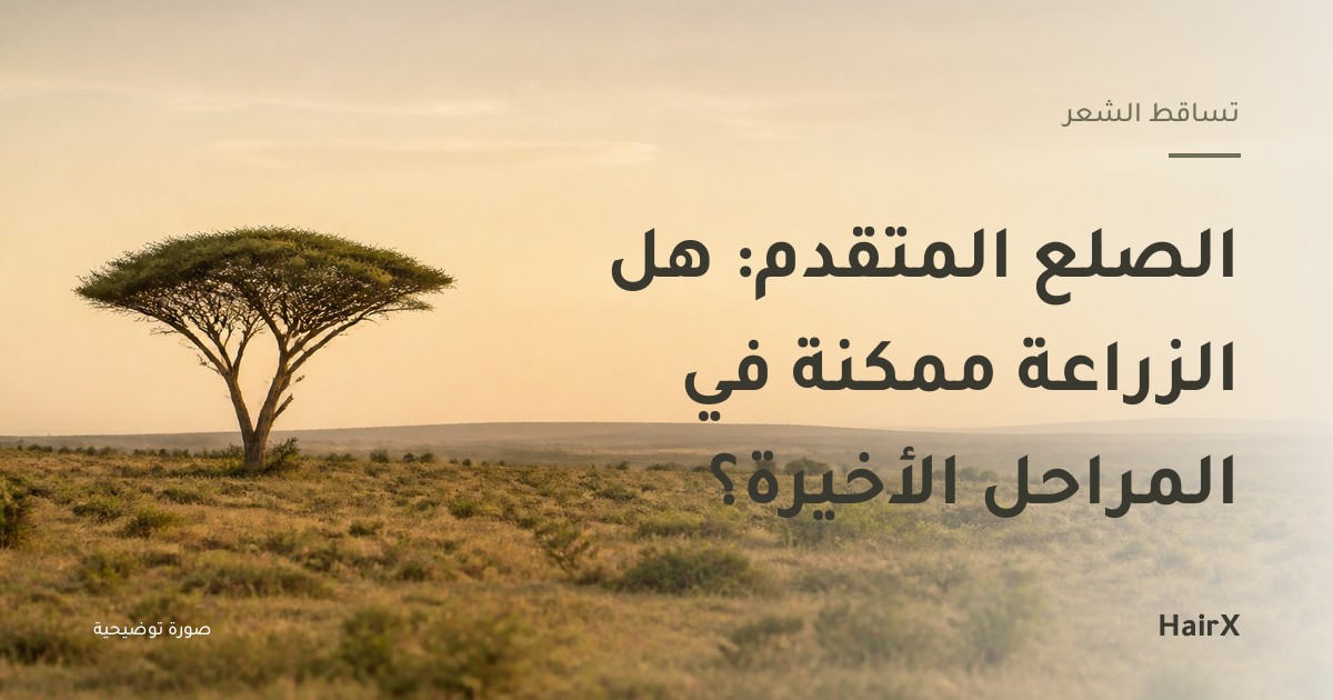 صورة توضيحية: أفق صحراوي واسع وشجرة سنط وحيدة عند الغروب — الصلع المتقدم والزراعة